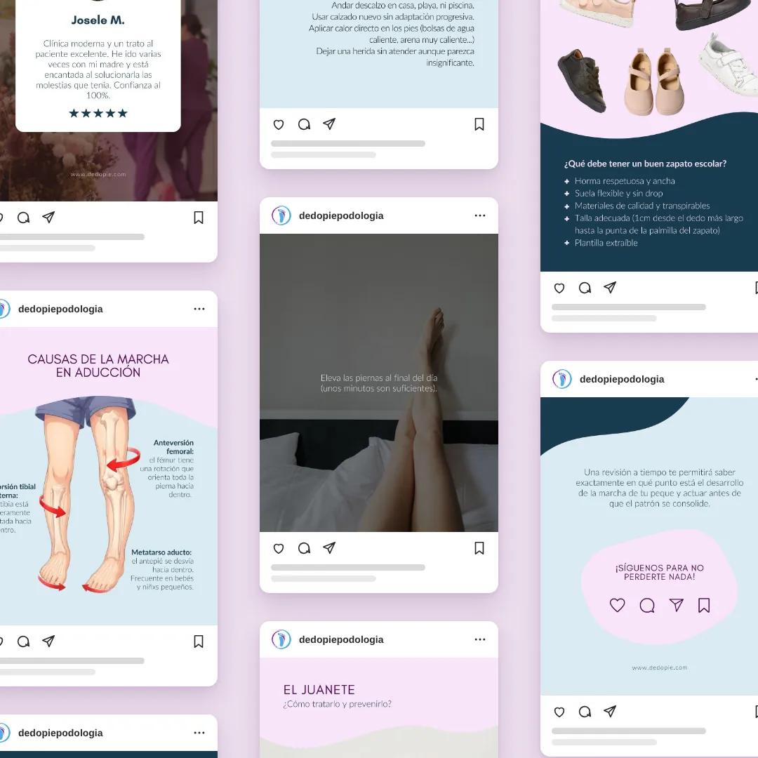 Exemples de publicacions d'Instagram de Dedopie Podologia